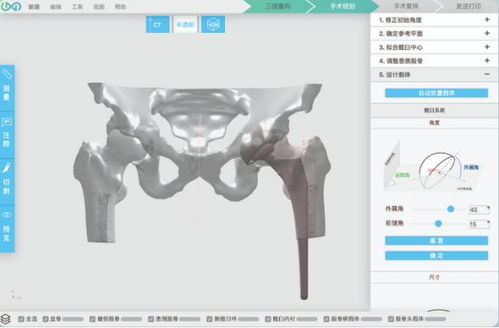 3d打印人體骨骼 這家哈佛大學孵化的公司要為中國醫生開發自己的軟件平臺...